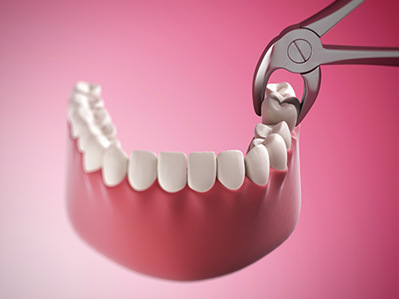The image depicts a pair of scissors cutting into a set of human teeth with visible roots, which are placed on a pink background.