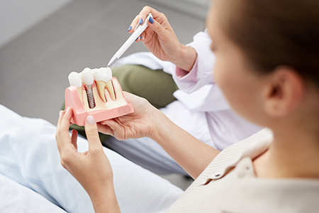 A woman holding a model of a tooth being prepared by a dental professional, likely for educational purposes.