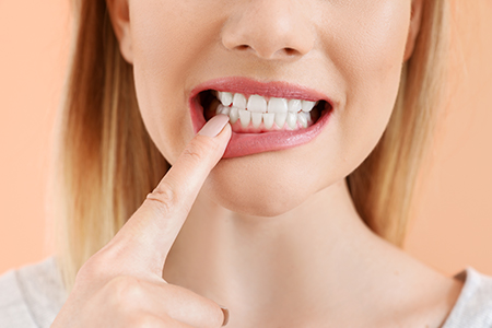 The image shows a woman with her finger on her teeth, holding her index finger up to her mouth, and appears to be pulling her tooth out with her hand.